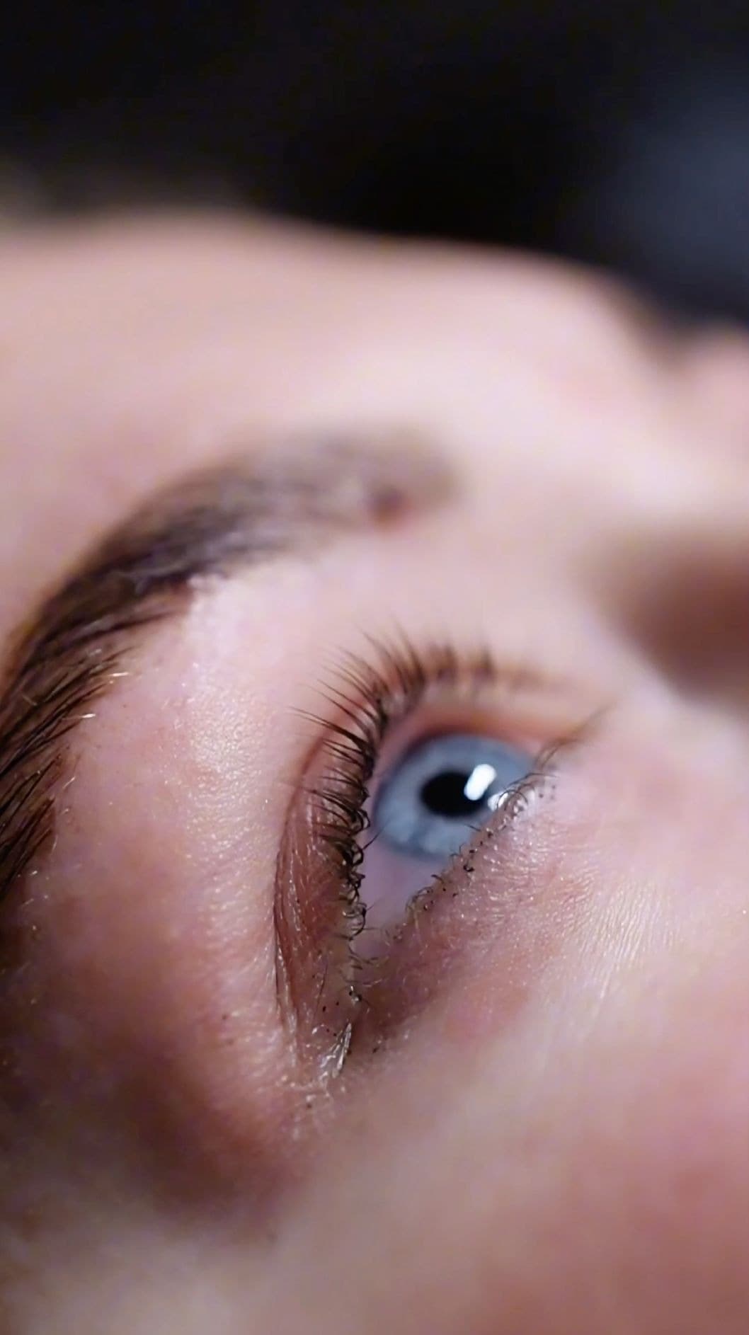 Augen