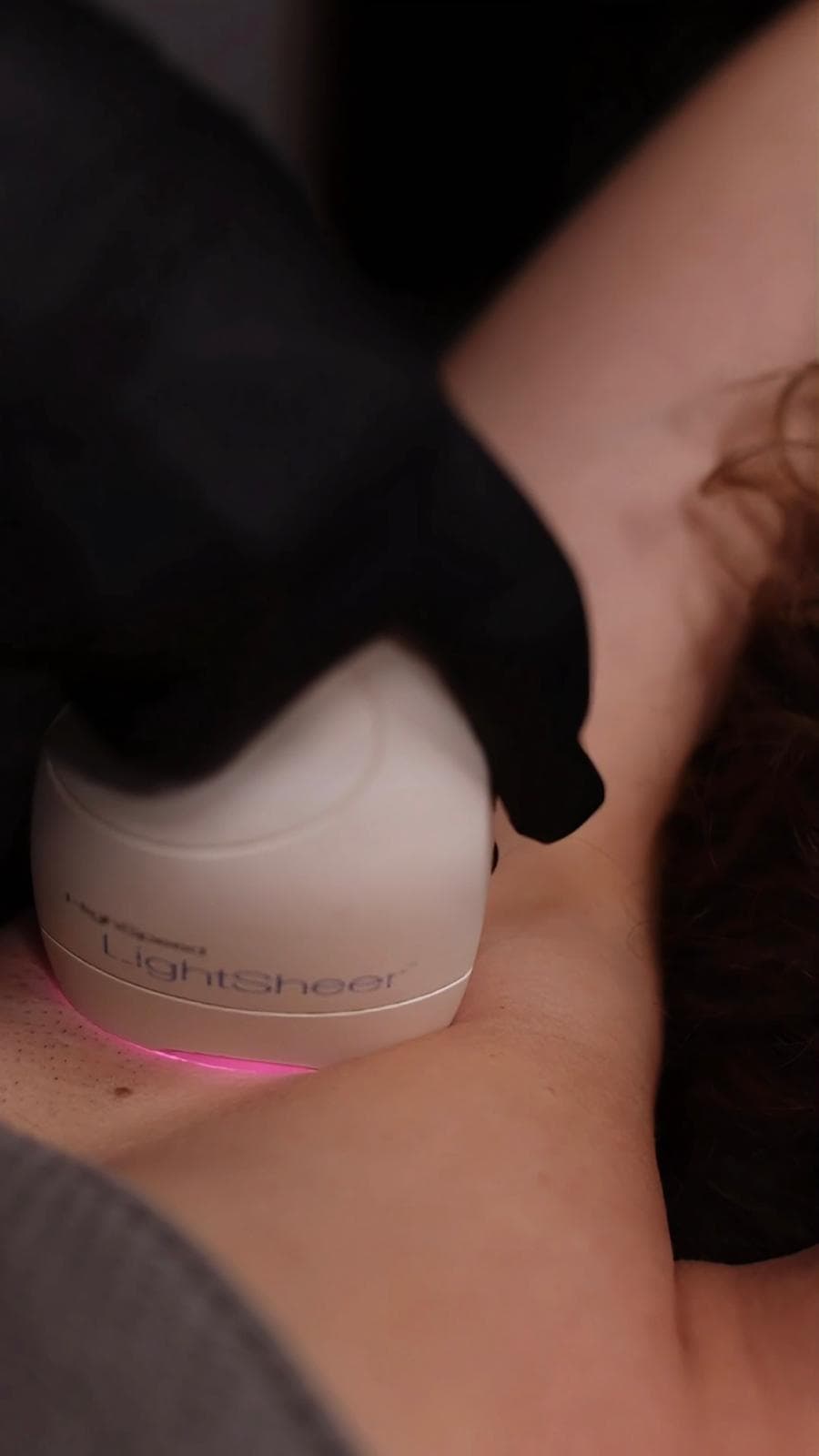 Laserbehandlung Oberkörper